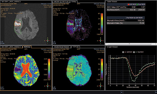 What Is Clinical Information Systems In Healthcare