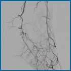 catalyst interventional radiology