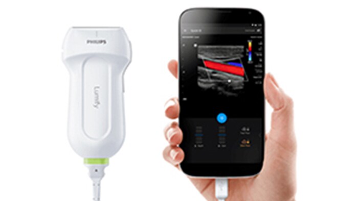 Lumify app-based ultrasound