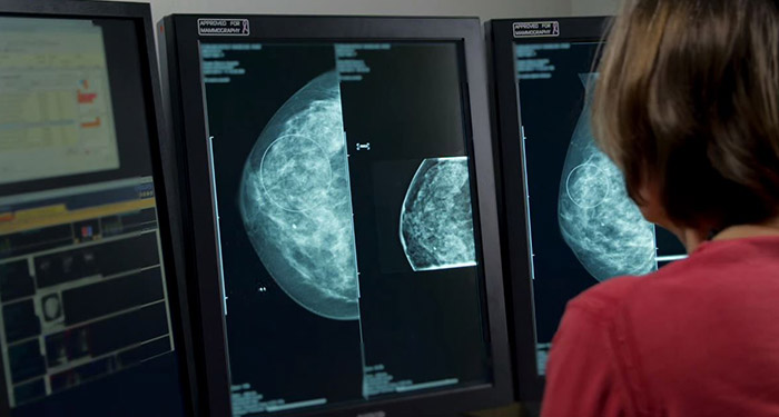 A video about PACS station into a mammography workstation