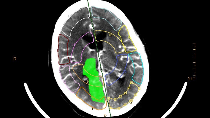 Advanced Visualization and Analysis in Radiology Imaging ...