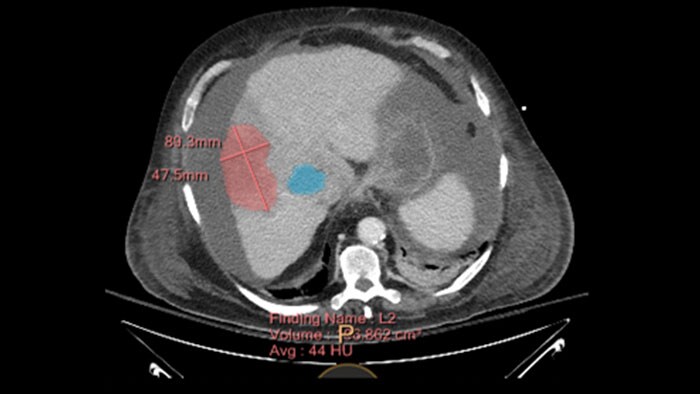 Application Browser Computed Tomography Philips Healthcare