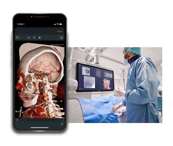 Azurion with StrokeViewer