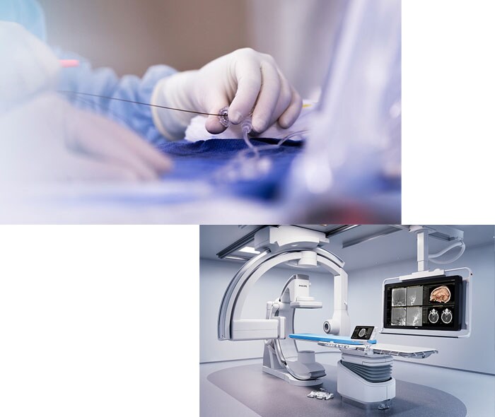 Azurion acute stroke