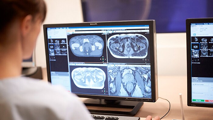 MRI: Insights that enhance your diagnostic confidence download (.pdf) file