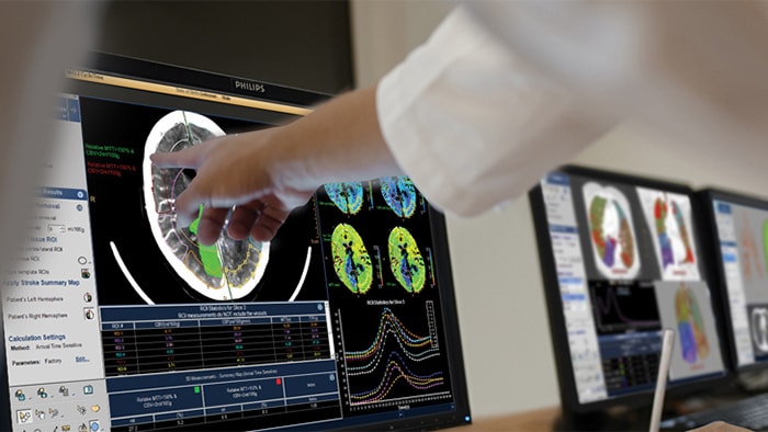 Philips radiology workflow solutions