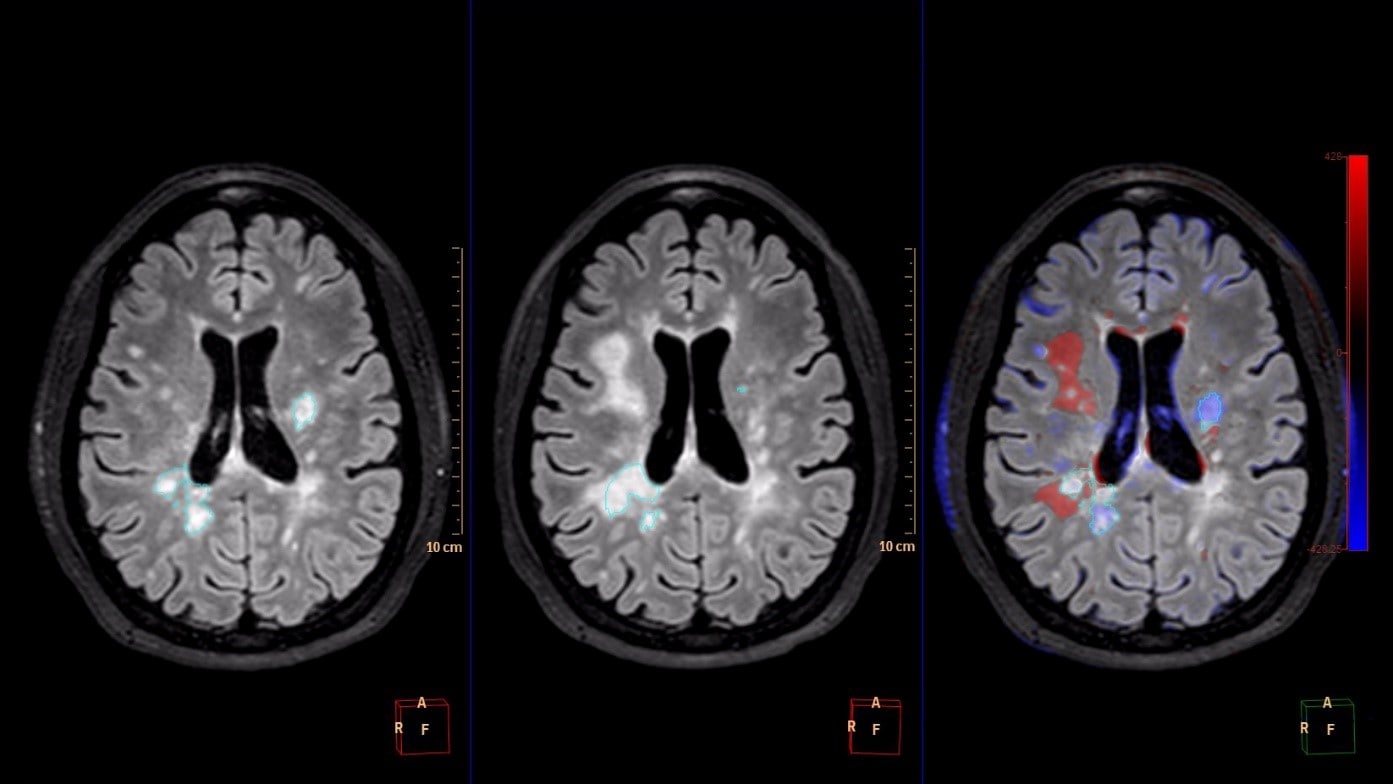 Comparative Brain Imaging download image