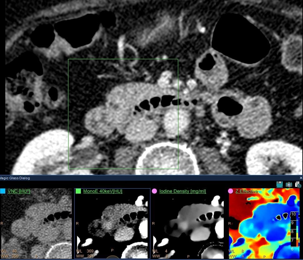 CT for the ED (opens in a new window) download image
