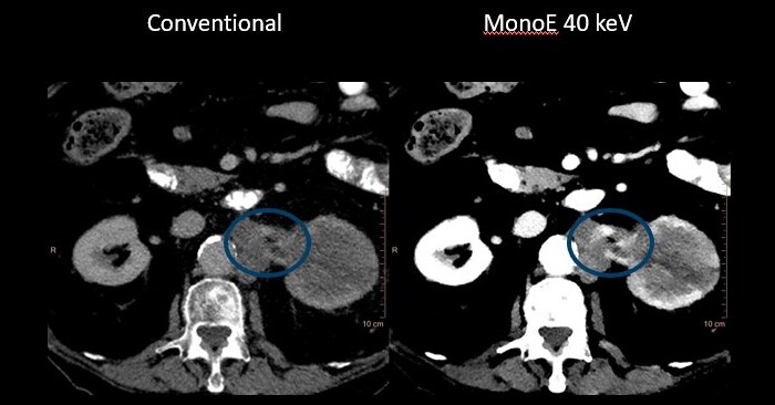 Diagnostic CT