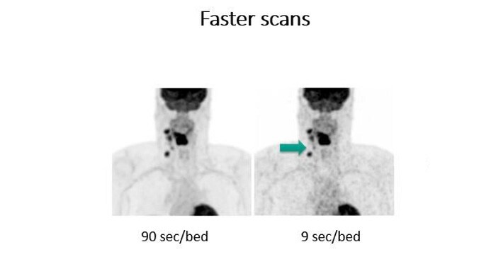 Neck Lesion