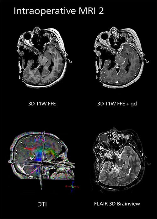 Intraoperative consultation - Libre Pathology