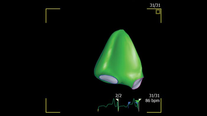 3d auto rv analysis 4