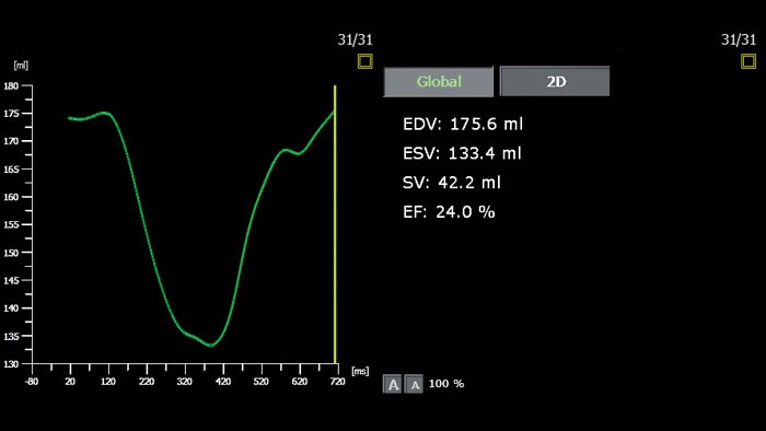 3d auto rv analysis 5