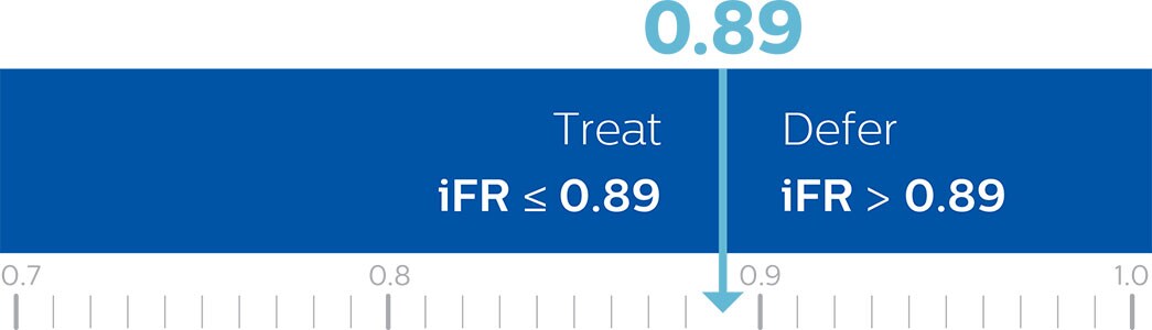 iFR cut point