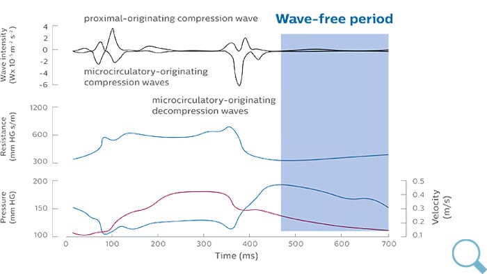 iFR wave-free period (opens in a pop up) download image