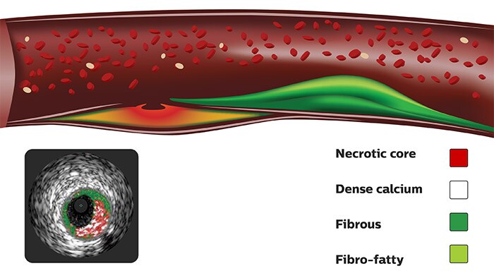 vhIvus colorizedTissue