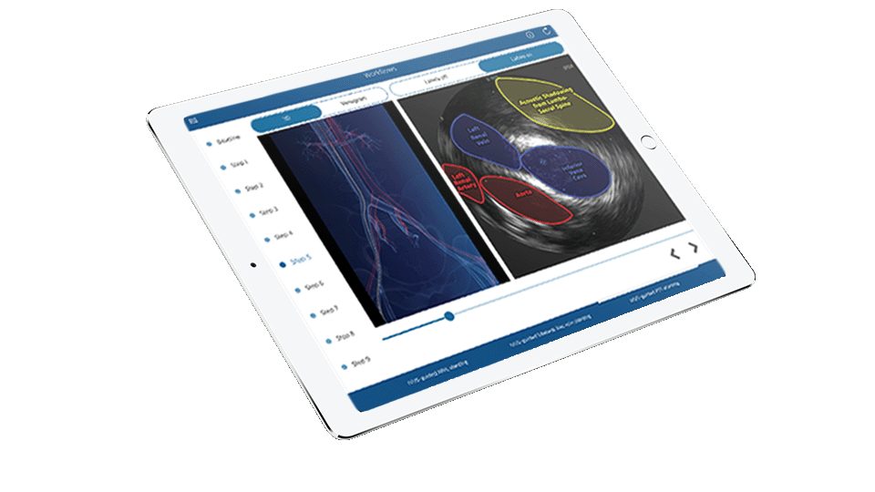 IVUS expert ipad