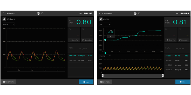 Ifr monitor (opens in a pop up) download image