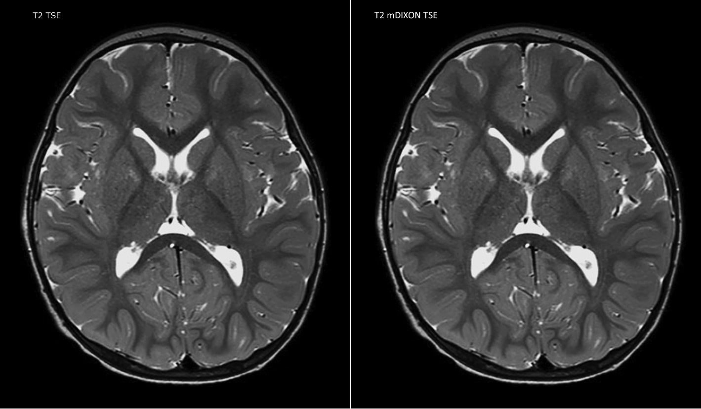 clinical case 4