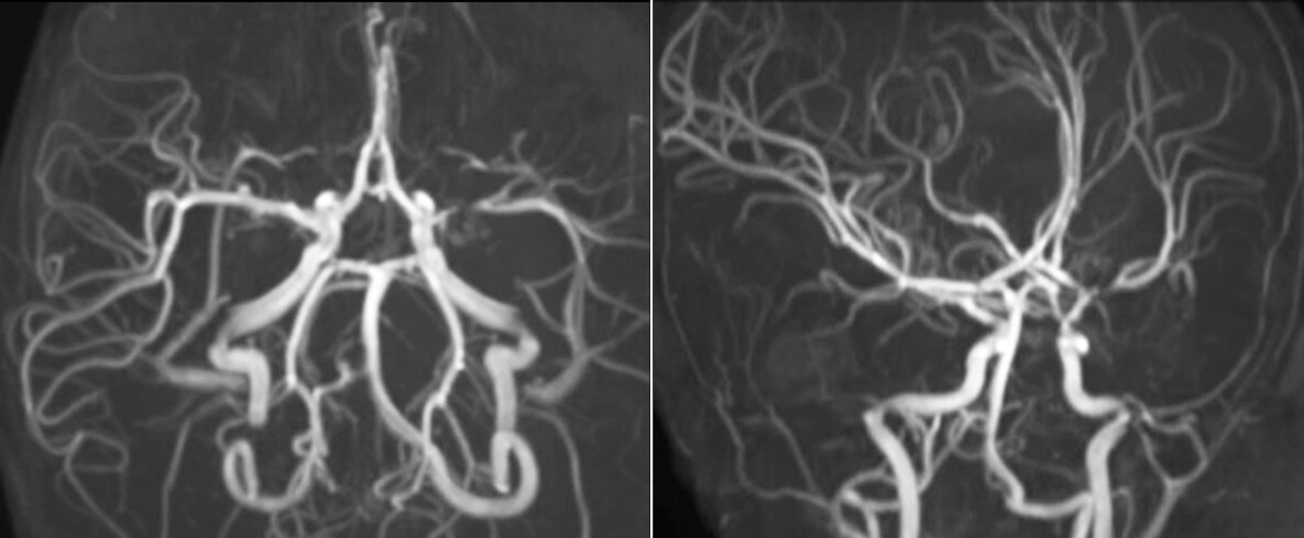 clinical case2