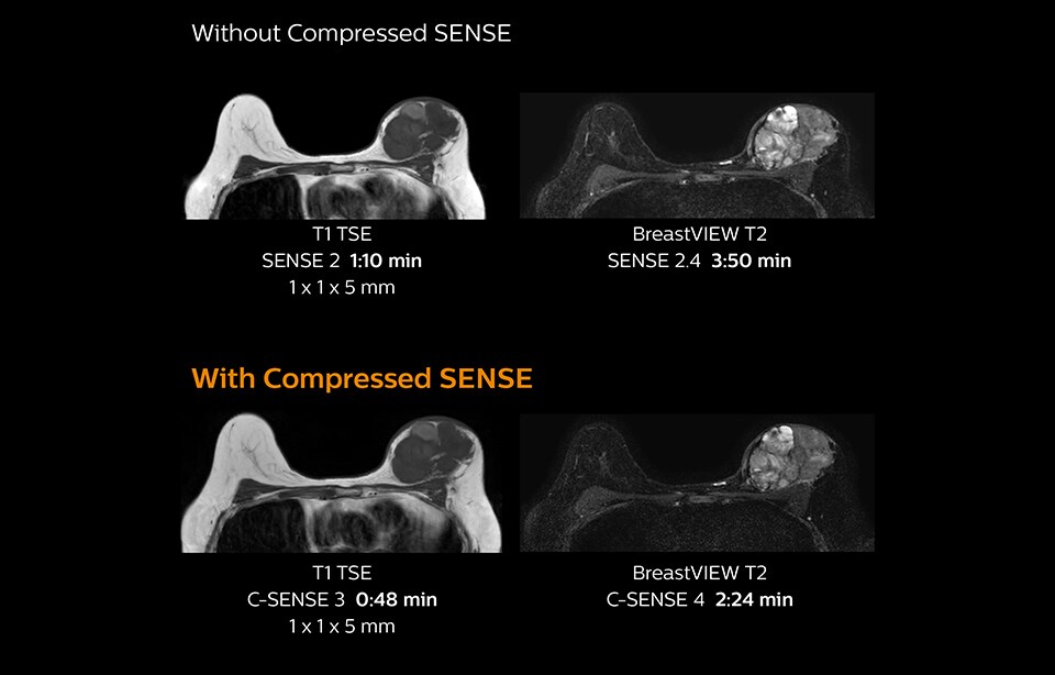 clinical image breast compressed sense us desktop