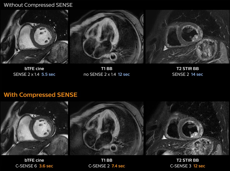 clinical image cardiac mri compressed sense us desktop