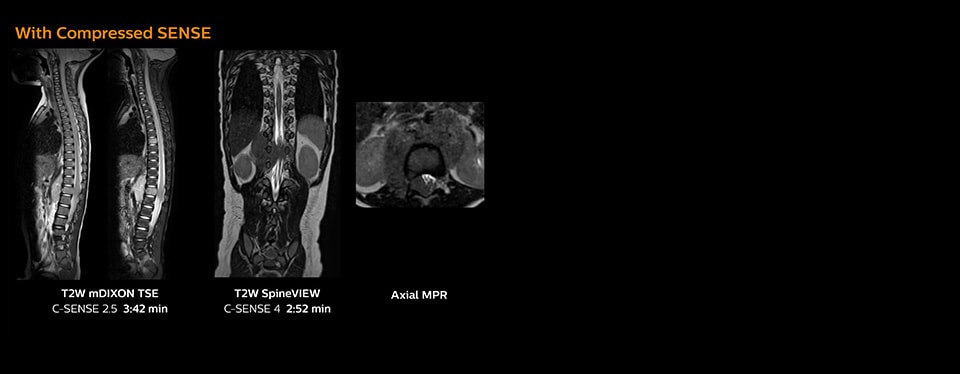 clinical image pediatric spine compressed sense us desktop
