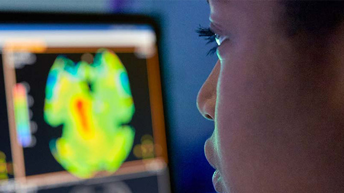 rsna event page thumbnail