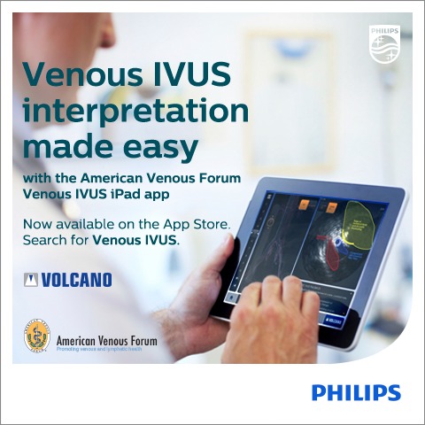 Venous IVUS App