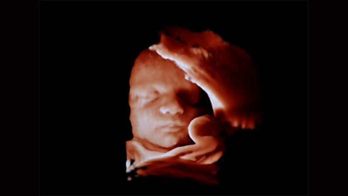 3d ultrasound image