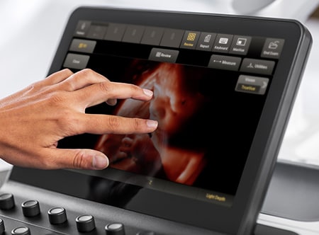 Philips obstetric ultrasound imaging with TrueVue.