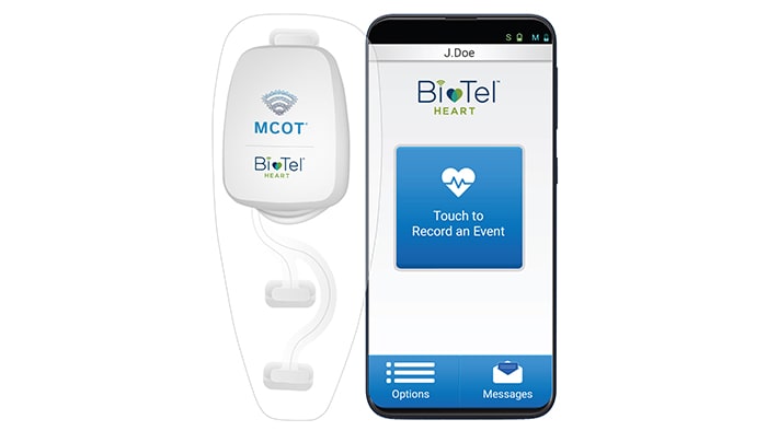 Mobile cardiac app on phone