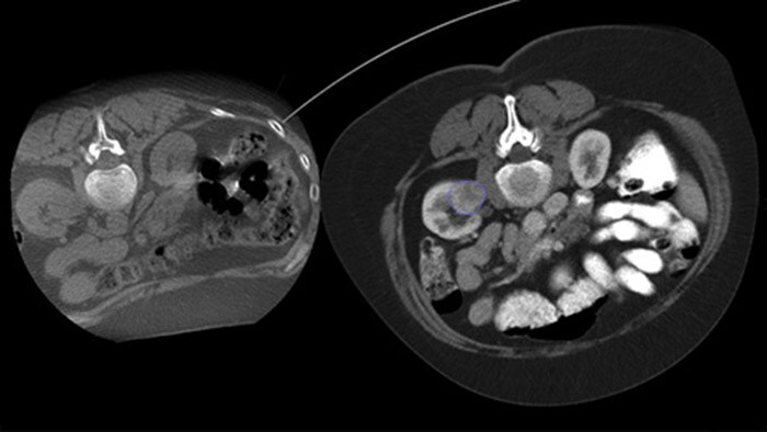 Cone Beam CT Dual View