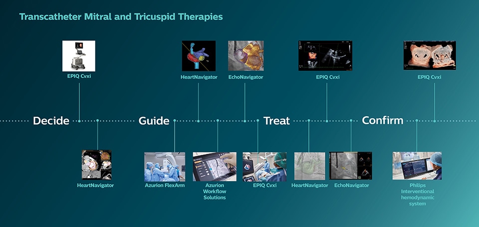 Transcatheter Mitral and Tricuspid Therapies