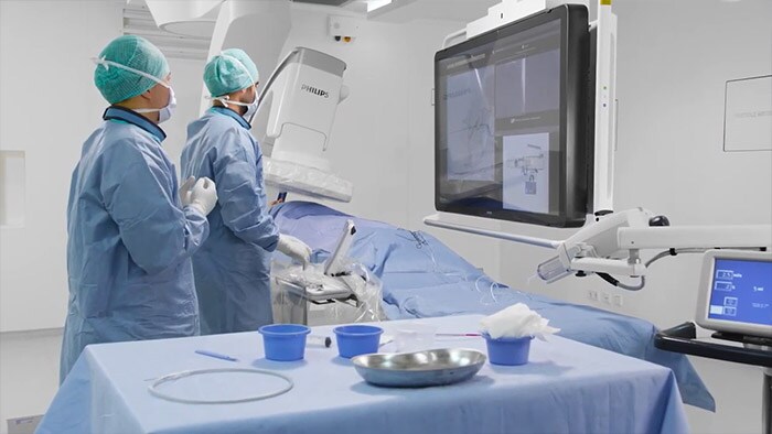 Philips SmartCT in trans arterial chemo embolization