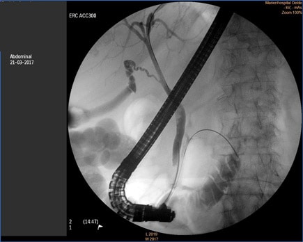 case1 image