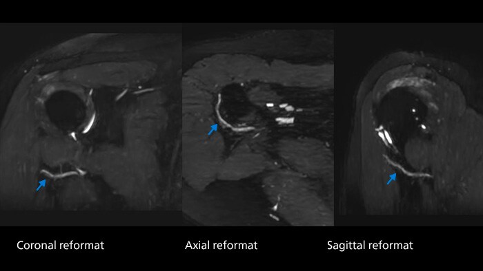 Nerve image one