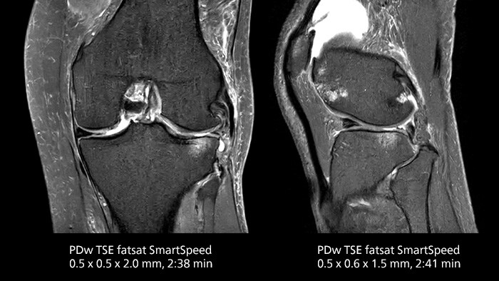 Knee image two