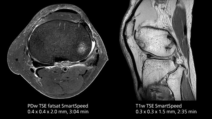 Knee image three