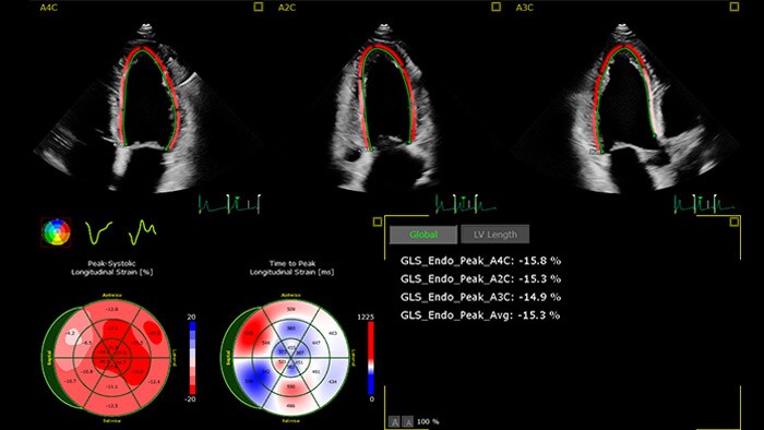 Ecocardiography screen