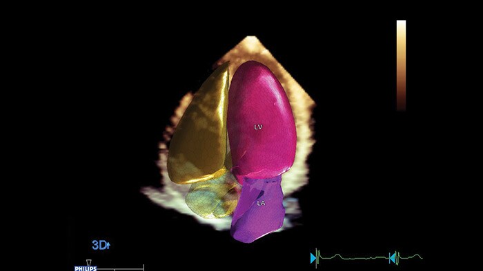 Cardiology quantification designed to increase confidence