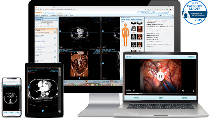 enterprise viewer thumbnail