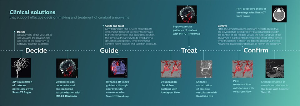 Clinical solutions for cerebral aneurysms (opens in a new window) download image