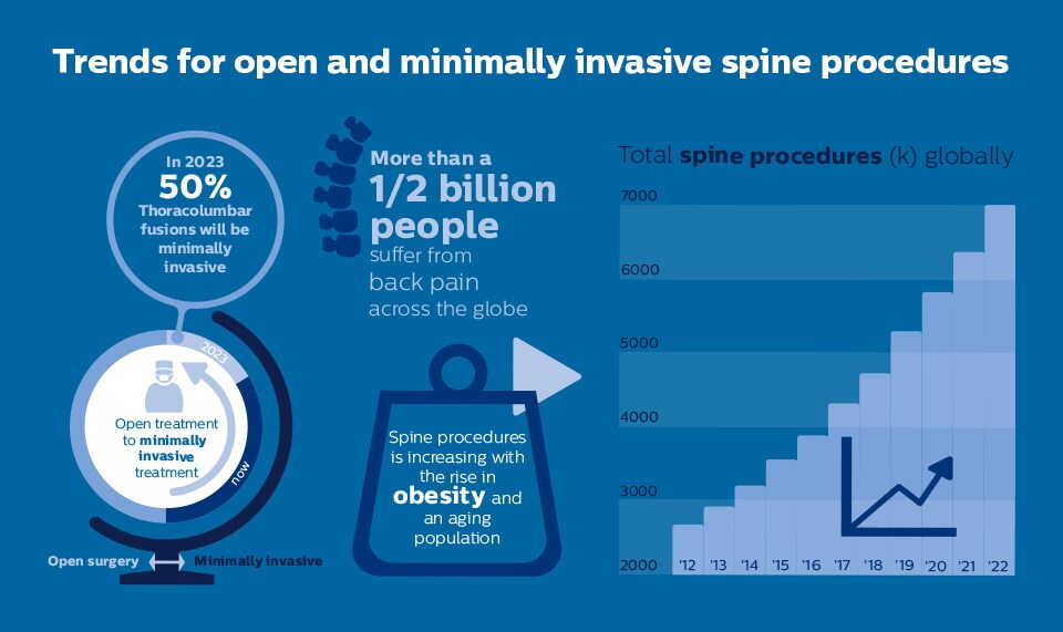 Spine Trends Infographic