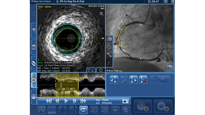 IntraSight interface with diameter measurements