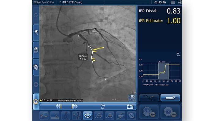 IntraSight Interface