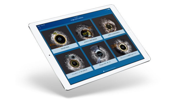 Tablet with IVUS