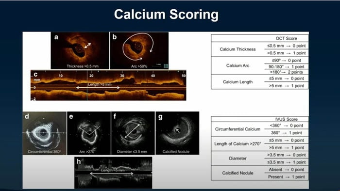 Management of coronary calcium in ULC PCI