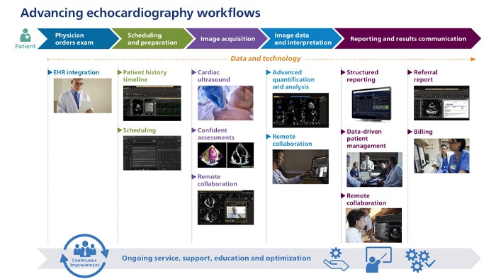 Advanced echocardiography workflows video thumbnail showing a flowchart of how the workflow works
