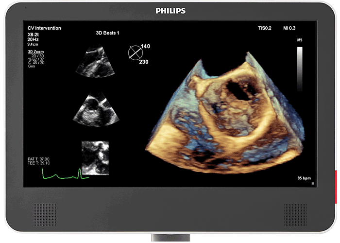 Changing to meet your challenges Philips